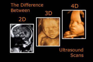 different types of scans